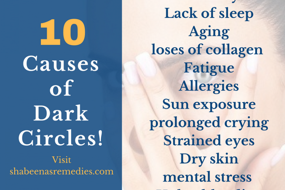 What Causes Dark Circles Under Eyes